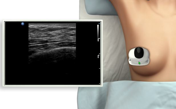 Ultrasound Assessment of the Female Breast