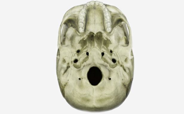 Radiography of the Skull, Cranial and Facial Bones, and Parana...