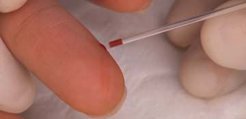 Phlebotomy