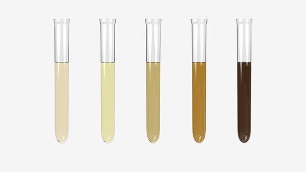 Perform Routine Clinical Urinalysis Test